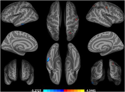 Differential Impact of Education on Gray Matter Volume According to Sex in Cognitively Normal Older Adults: Whole Brain Surface-Based Morphometry